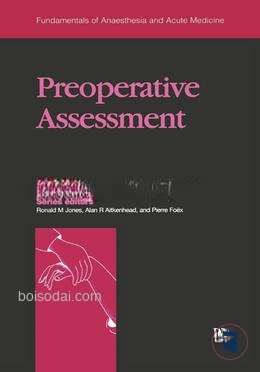 Preoperative Assessment
