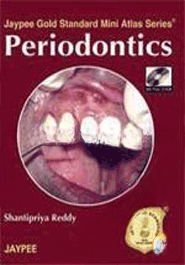 Periodontics (with Photo CD Rom) (Jaypee Gold Standard Mini Atlas Series) (Paperback)