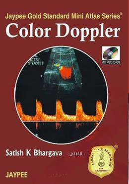 Color Doppler - (with CD Rom)