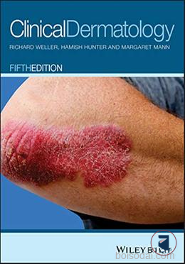 Clinical Dermatology