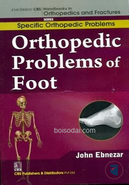 Orthopedic Problems of Foot
