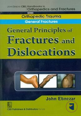 General Principles of Fractures and Dislocations