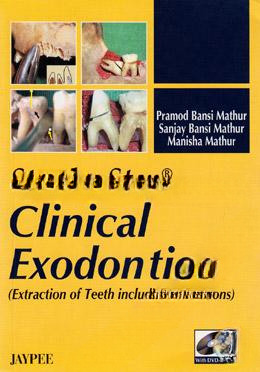 Step by Step Clinical Exodontics (with DVD Rom)
