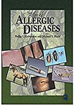 Atlas of Allergic Diseases — ছবি 2