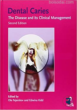 Dental Caries