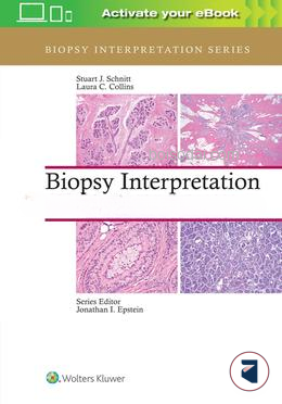 Biopsy Interpretation of the Breast