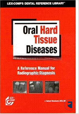 Oral Hard Tissue Diseases