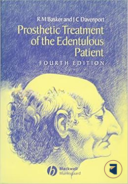 Prosthetic Treatment of the Edentulous Patient