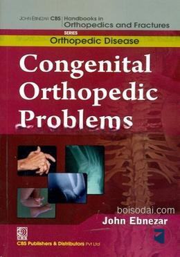 Congenital Orthopedic Problems