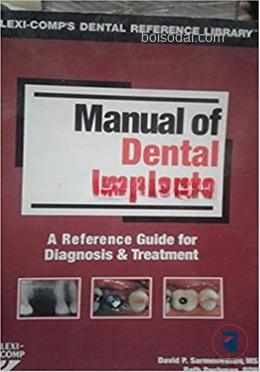 Manual of Dental Implants