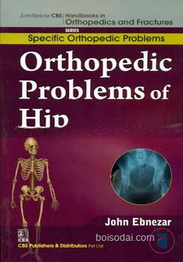 Orthopedic Problems of Hip (Handbooks in Orthopedics and Fractures Series, Vol. 40