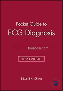 Pocket Guide to ECG Diagnosis
