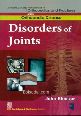 Disorders Of Joints (Handbooks In Orthopedics And Fractures Series, Vol. 32