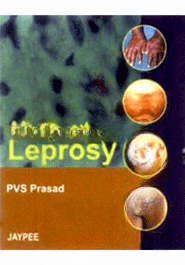 All About Leprosy