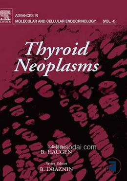 Thyroid Neoplasms