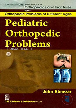Pediatric Orthopedic Problems — ছবি 2