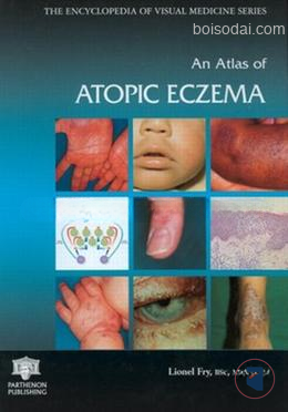 An Atlas of Atopic Eczema