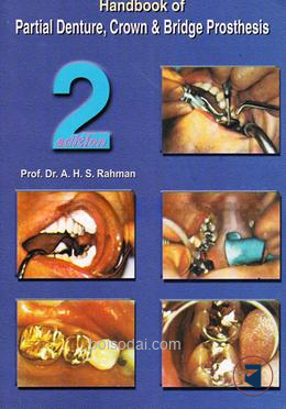 Handbook of Partial Denture, Crown and Bridge Prosthesis