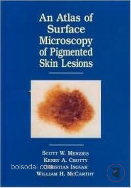 Atlas of the Surface Microscopy of Pigmented Skin Tumour