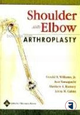 Shoulder and Elbow Arthroplasty