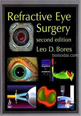 Refractive Eye Surgery