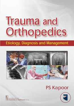 Trauma And Orthopedics Etiology, Diagnosis And Management