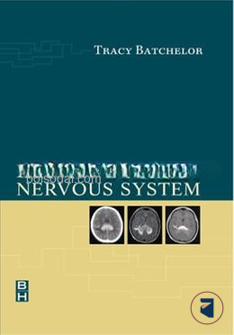 Lymphoma of the Nervous System