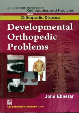 Developmental Orthopedic Problems