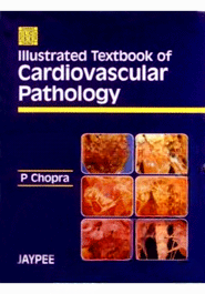 Illustrated Textbook of Cardivascular Pathology (Paperback)