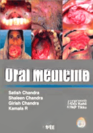 Oral Medicine