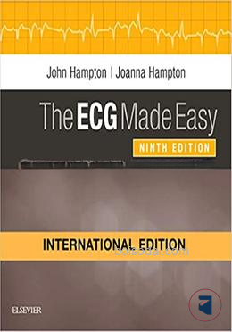 The ECG Made Easy