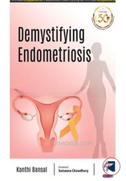 Demystifying Endometriosis