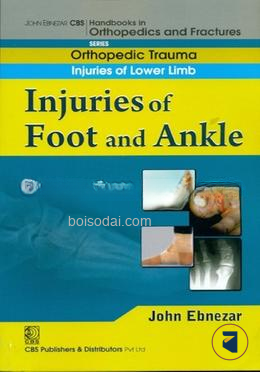 Injuries of Foot and Ankle