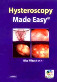 Hysteroscopy Made Easy (Paperback)