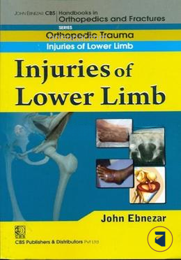 Injuries of Lower Limb