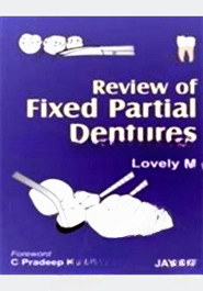 Review of Fixed Partial Dentures
