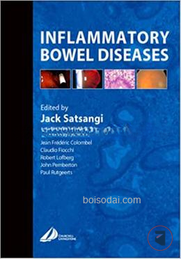 Inflammatory Bowel Diseases
